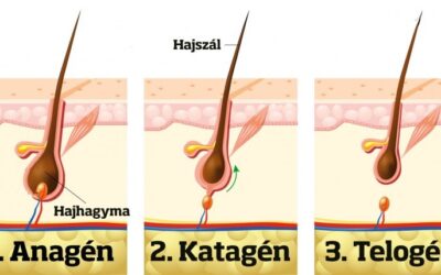 Mi is az a hajhullás?